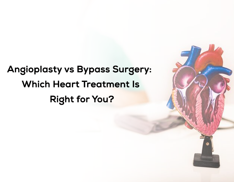 Angioplasty vs Bypass Surgery: Which Heart Treatment Is Right for You?
